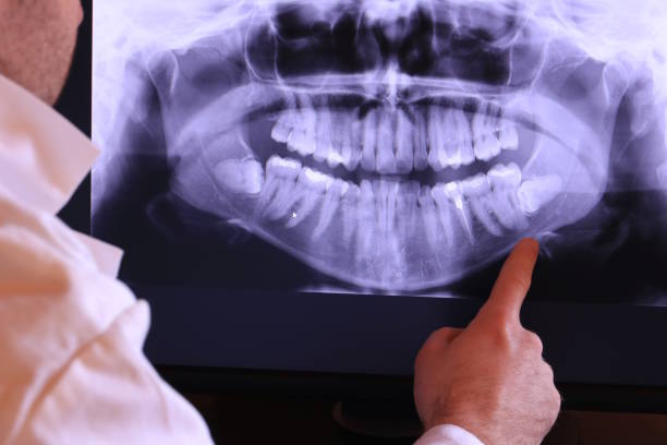 Best Tooth Pain Emergency Relief  in Madison, IL